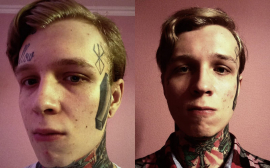 Денис Шальных показал лицо после процедуры по удалению татуировок