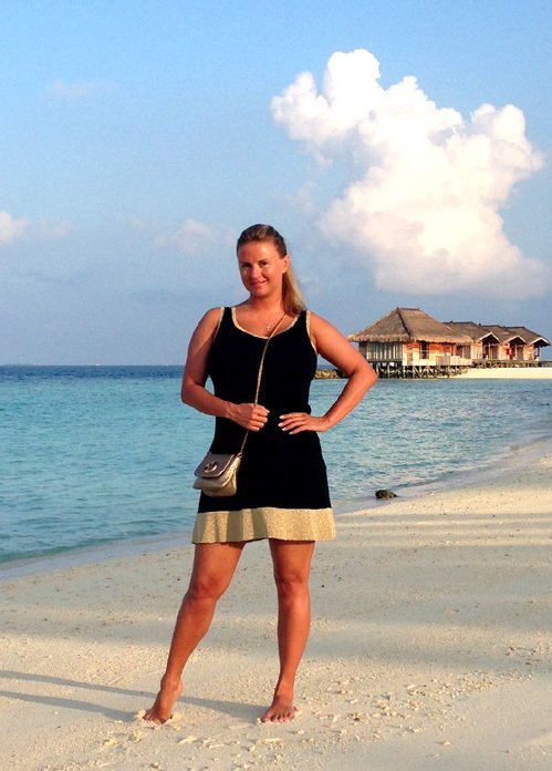 Анна Семенович сильно обгорела на сейшельском пляже