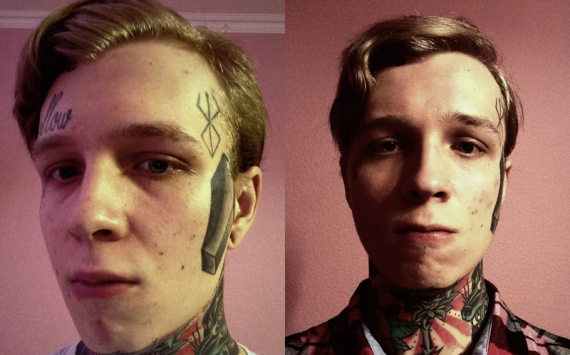 Денис Шальных показал лицо после процедуры по удалению татуировок