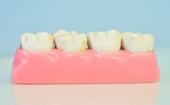 Эксперты назвали полезные для зубов продукты