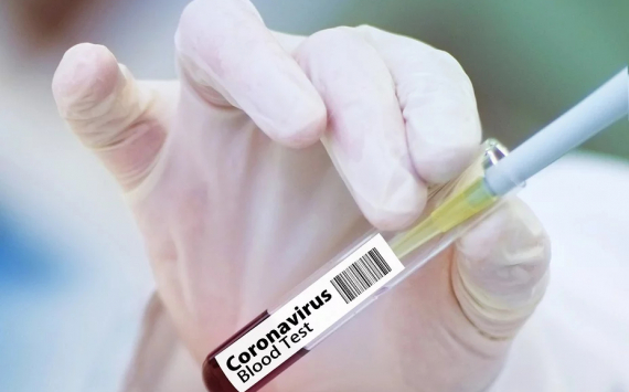 «Ренова» Вексельберга передаст в регионы своей деятельности экспресс-тесты на коронавирус