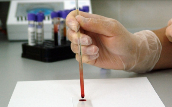 Ученые научились выявлять рак по одной капле крови