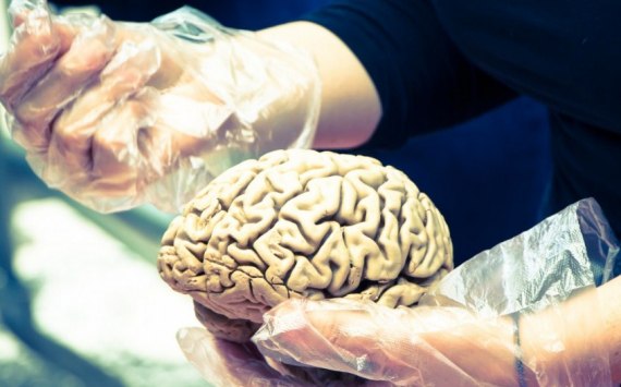 Ученые нашли причину уменьшения мозга современного человека