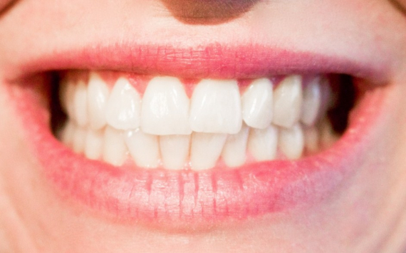 Стоматолог Баринова назвала 3 причины появления боли в зубах на холоде